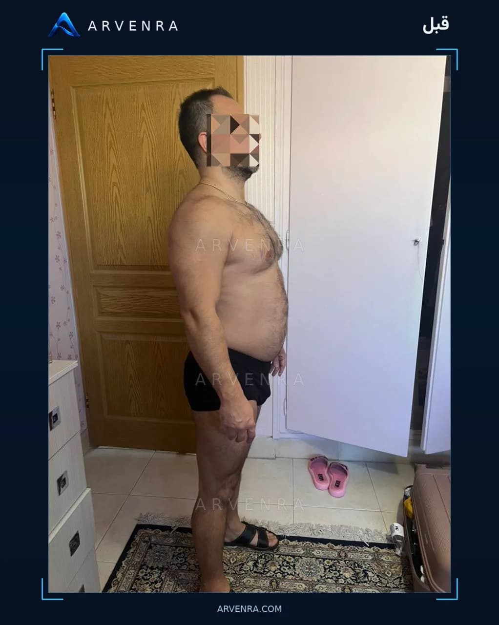 پیش از شروع